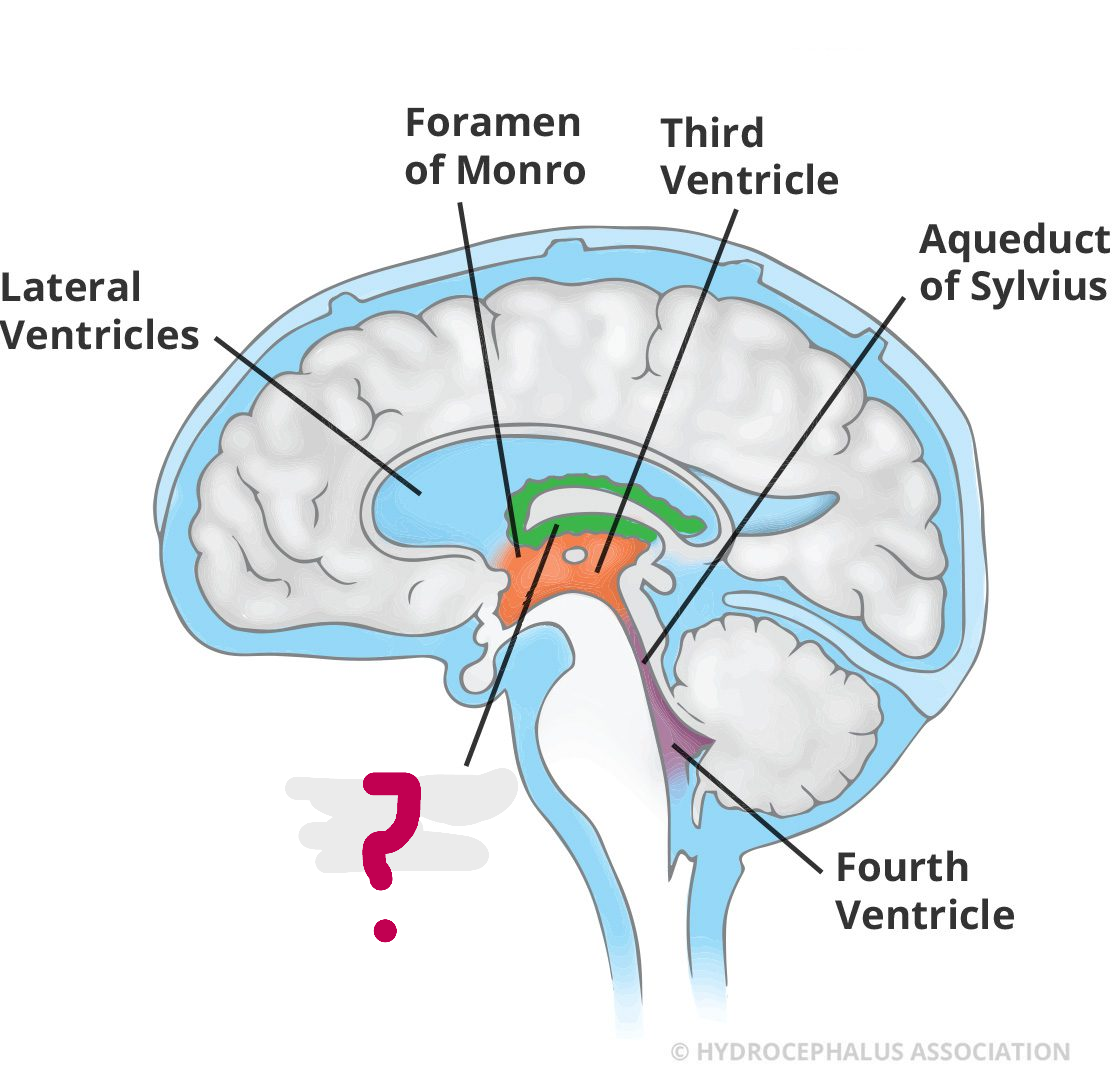 <p>What is this </p>