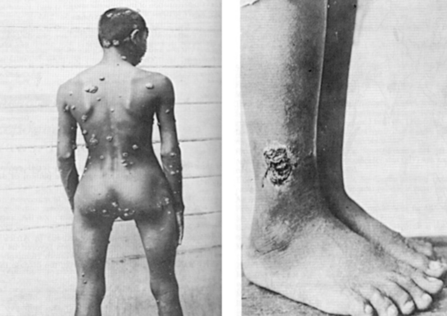 <p>Skin, bone, joints</p>