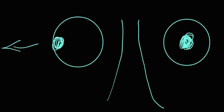 <p>lateral rectus muscle </p>