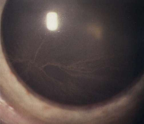 <p>What condition is this?</p>