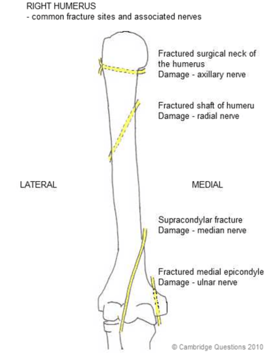 <p>Which part of humerus fractured in patient with wrist drop?</p>