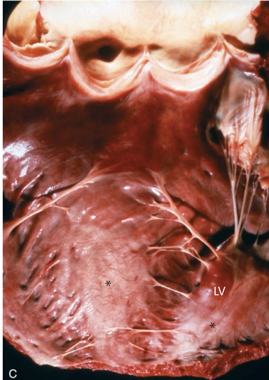 <p>what is the asterisk showing?</p>