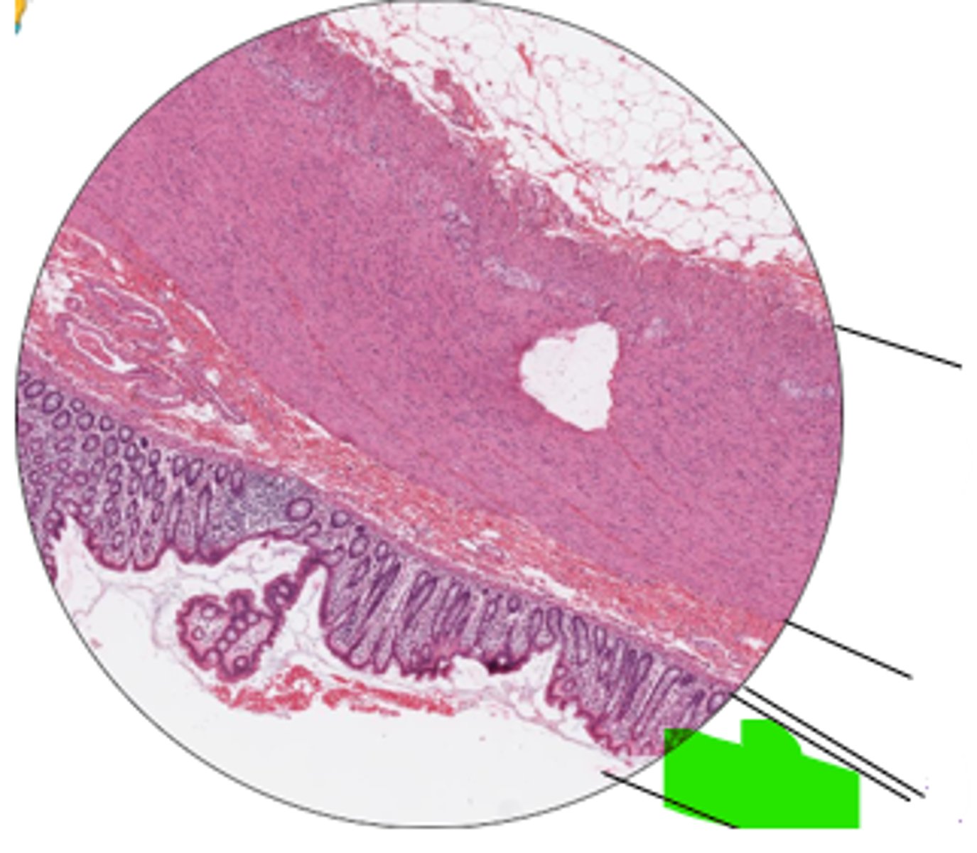 <p>region and organ?</p>