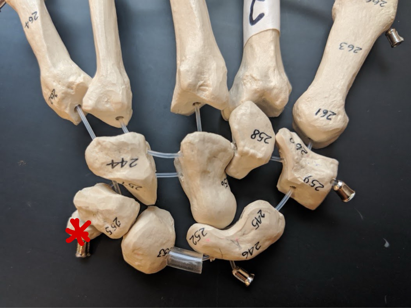 <p>Name this bone</p>