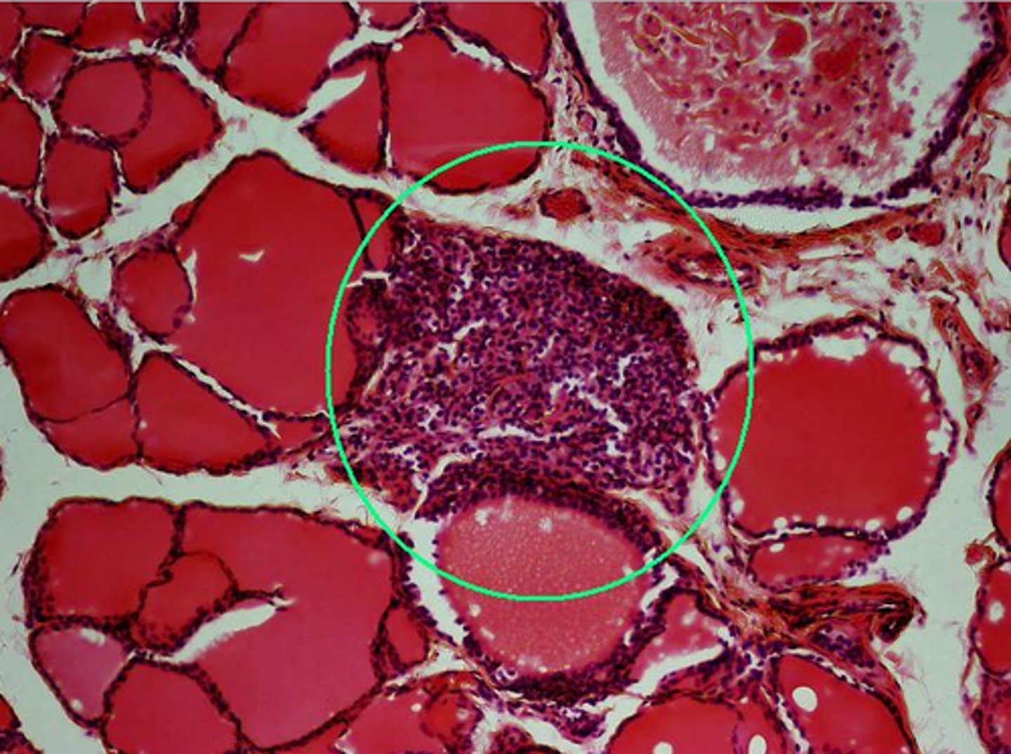 <p>Name a hormone produced by the indicated endocrine gland?</p>