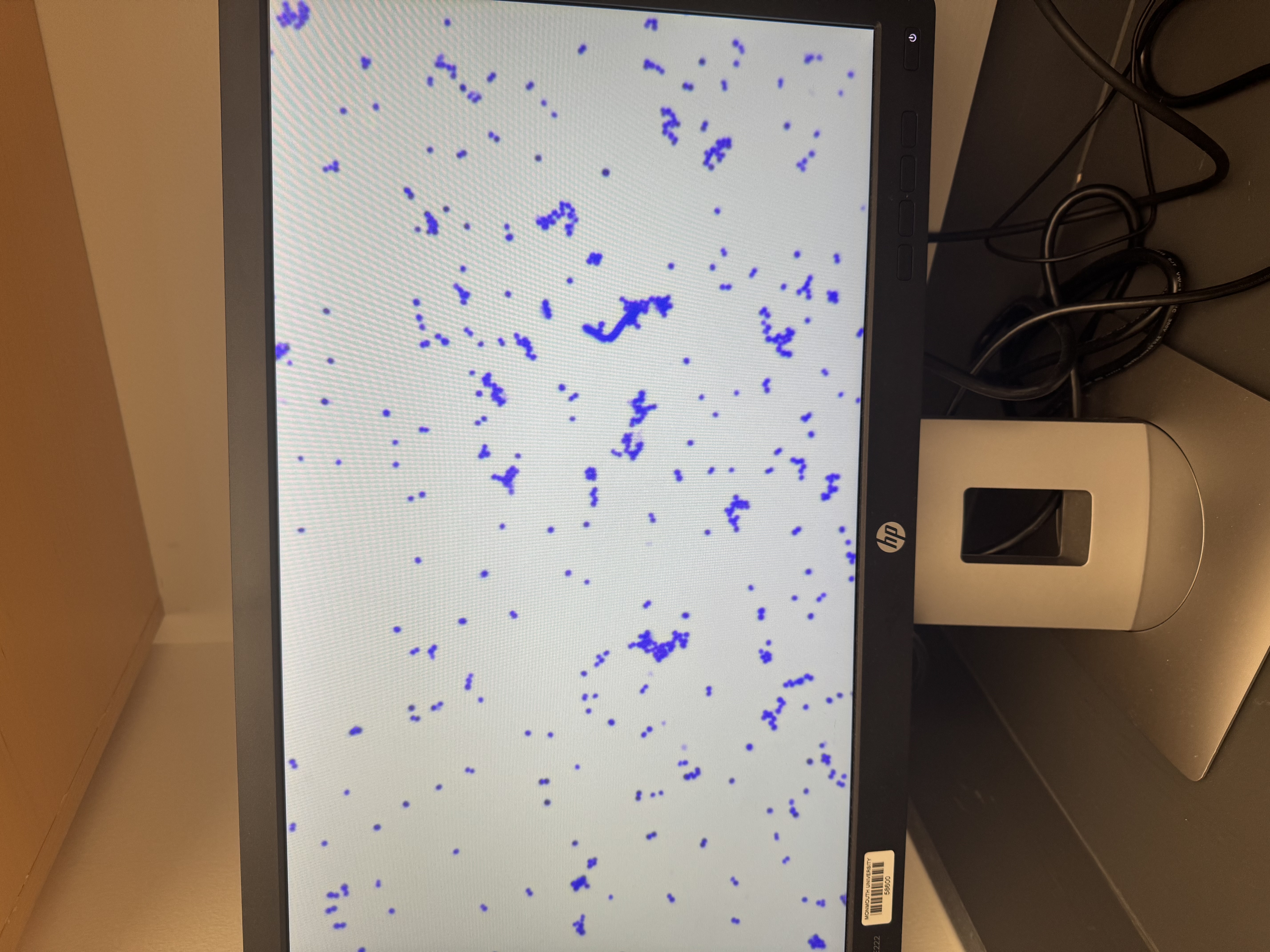 <p>Staphylococcus aureus</p>
