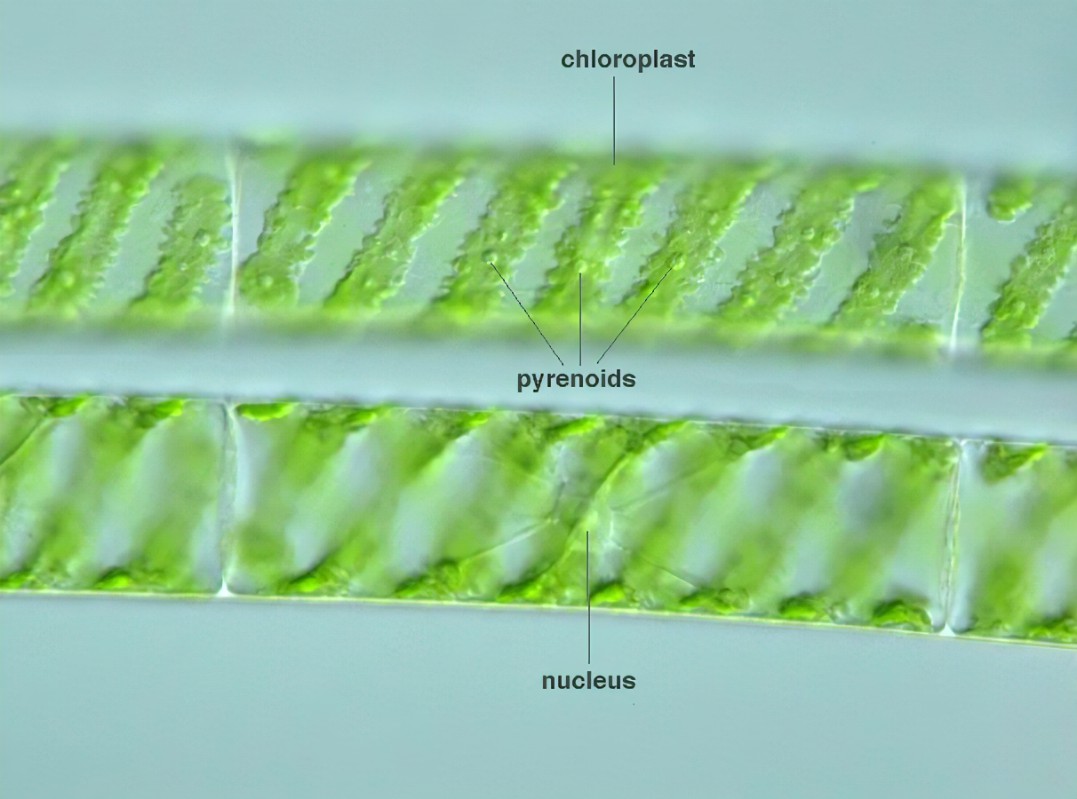 <p>Shape of the chloroplasts in <strong>spirogyra</strong></p>