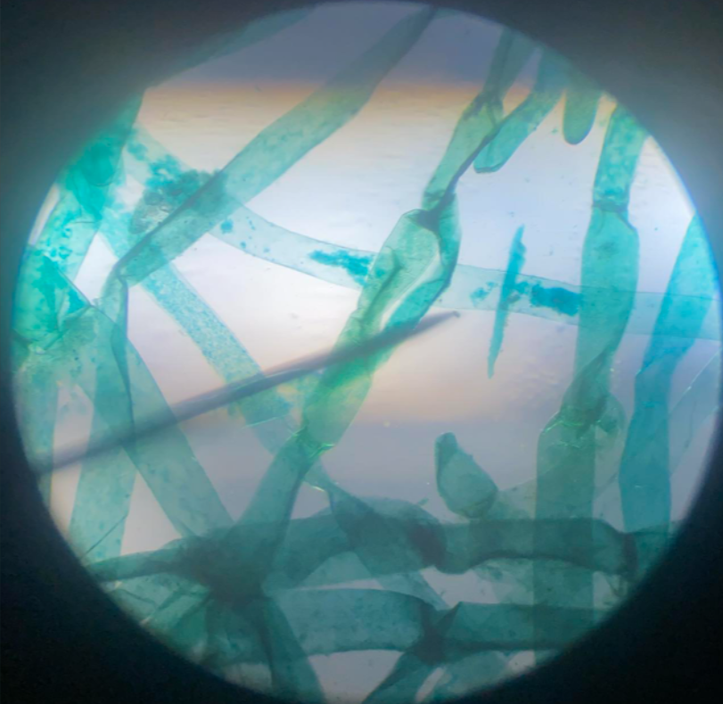 <p>Chlorophyta; branched filamentous green alga; freshwater/marine; diploid sporophyte/haploid gametophyte</p>