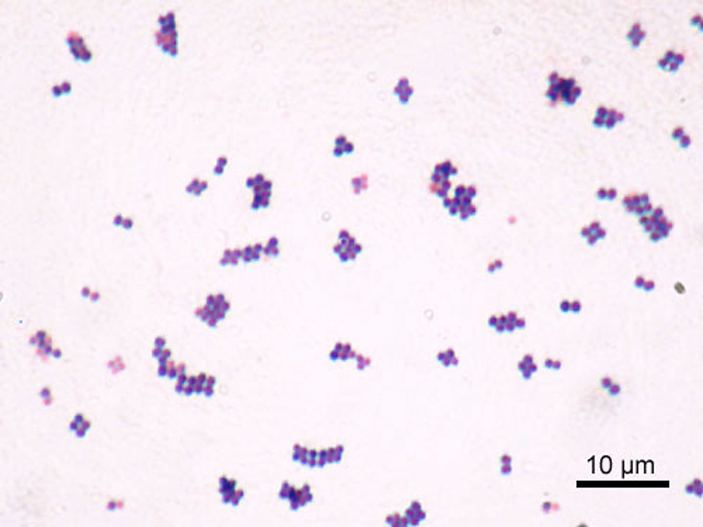 <p>moist-looking colonies, gram-positive cocci</p>