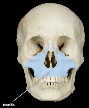 <p>maxilla bone</p><img src="https://knowt-user-attachments.s3.amazonaws.com/6024188d-c21d-4ba9-afc6-ec2b5cf21bb6.png" data-width="50%" data-align="center" alt="knowt flashcard image"><p></p>