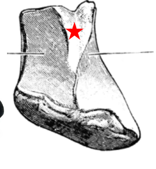 lesser multangular, smallest carpal, boot shaped