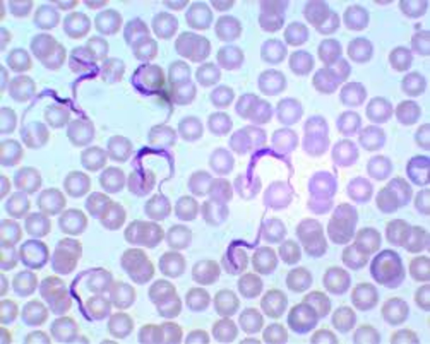 <p>The trypomastigote stage found in peripheral blood is diagnostic for the identification of Chagas disease, a disorder caused by which organism?</p>