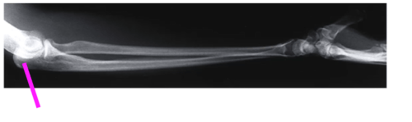 <p>what does this pink line point to?</p>