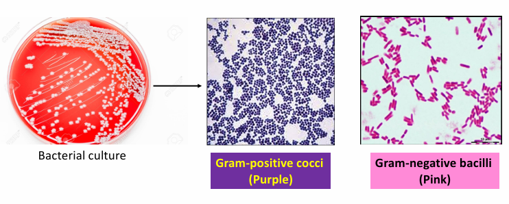 <p>Direct or indirect method of staining?</p>