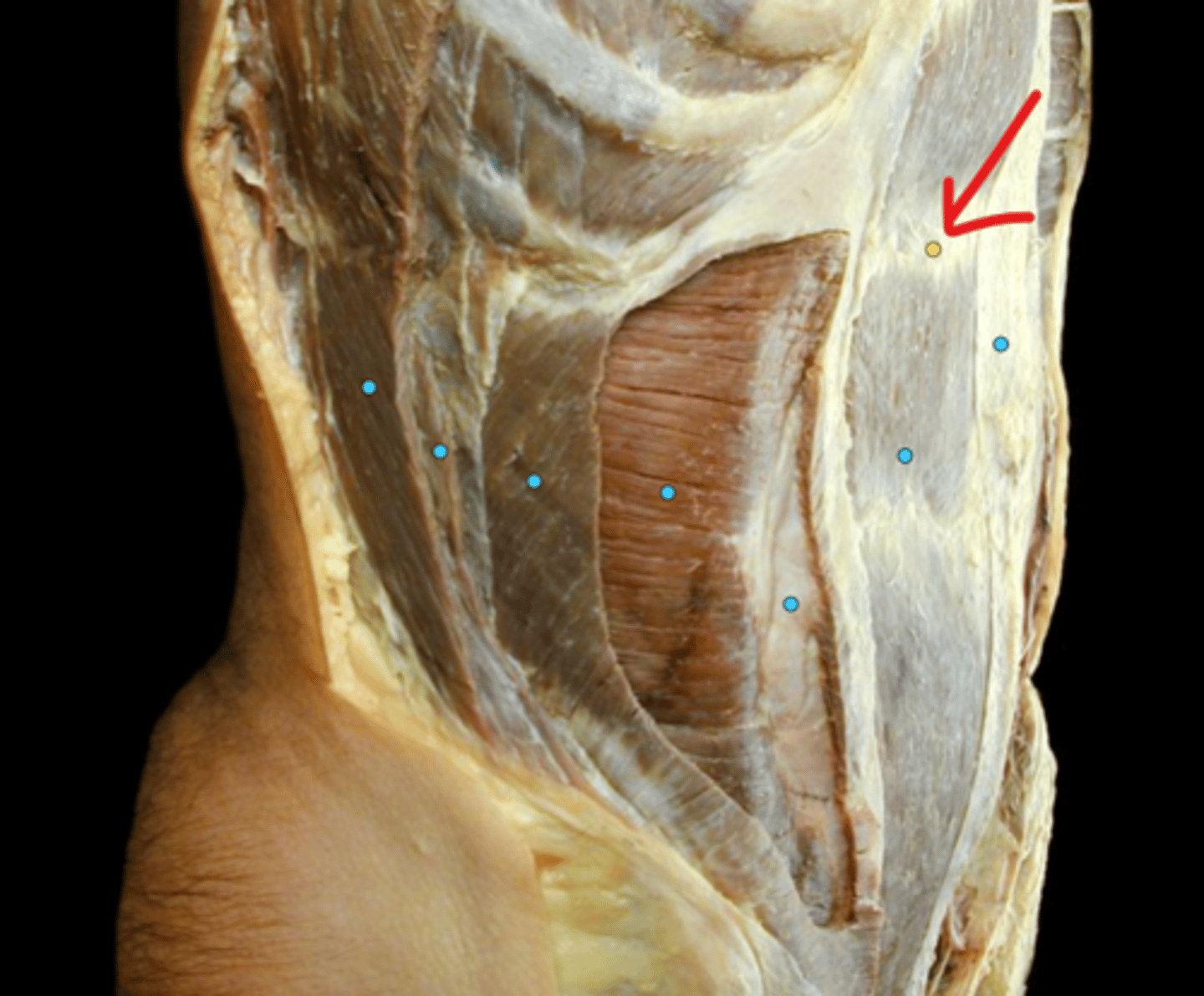 knowt flashcard image