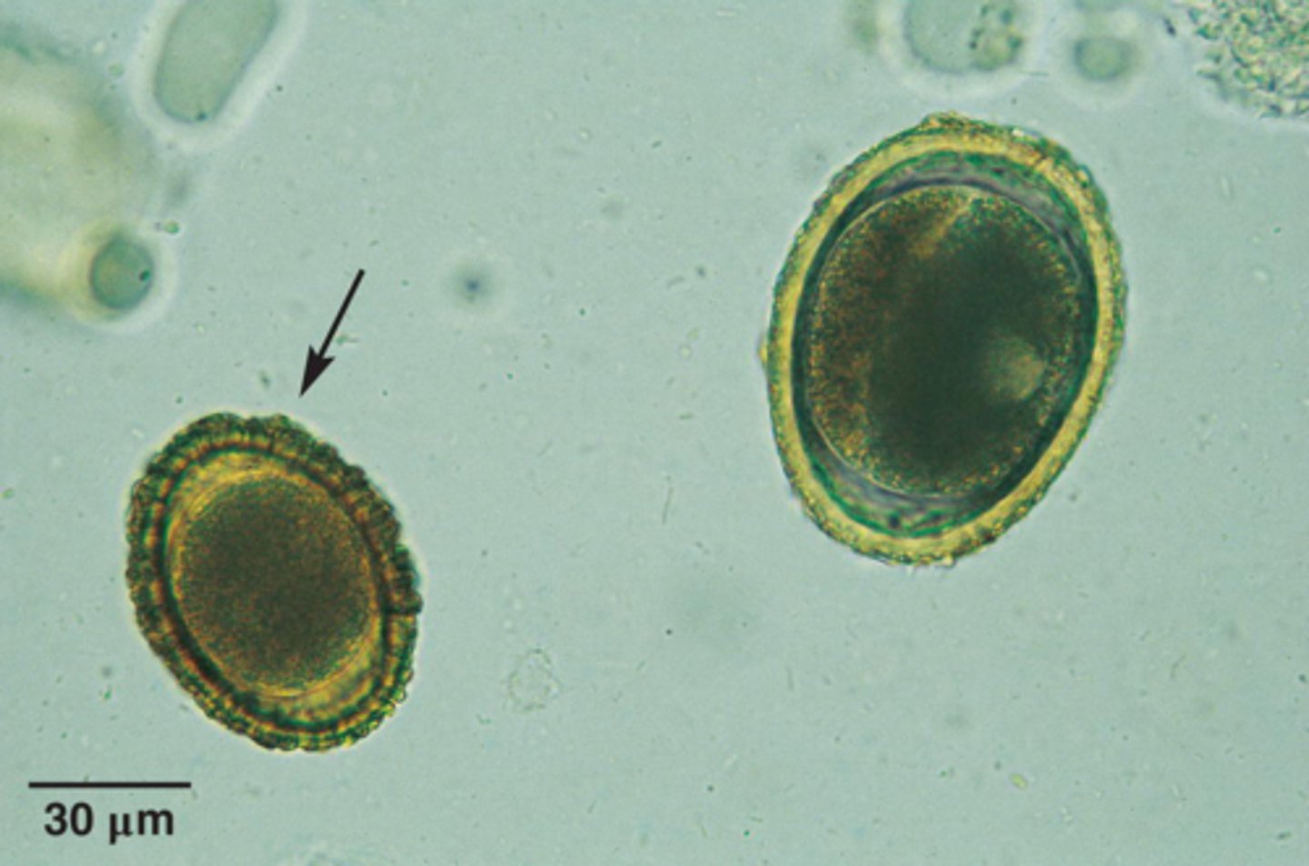 <p>Which parasite is NOT pointed to by an arrow if it is from a dog</p>