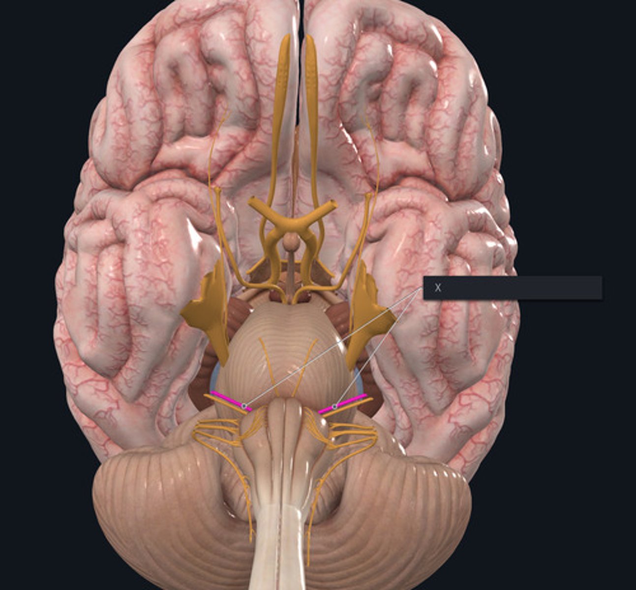 <p>Name the Nerve highlighted purple and indicated by the X.</p>