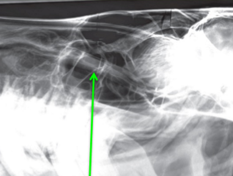 <p>Identify the structure</p>
