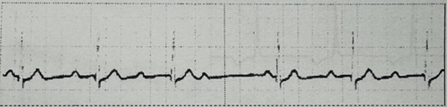 <p>identify the rhythm</p>