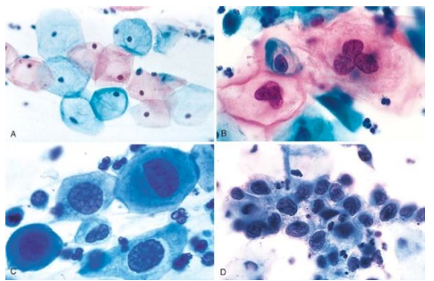 <p>procedure to test for cervical cancer in women, it involves collecting cells from the cervix</p>