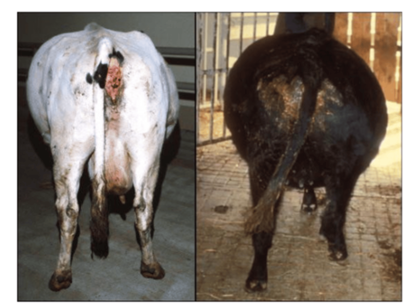 <p>accumulation of gas, causing distension of the rumenoreticulum with the gases of fermentation</p><p>aka ruminal tympanism</p><p>acute (sometimes chronic)</p>