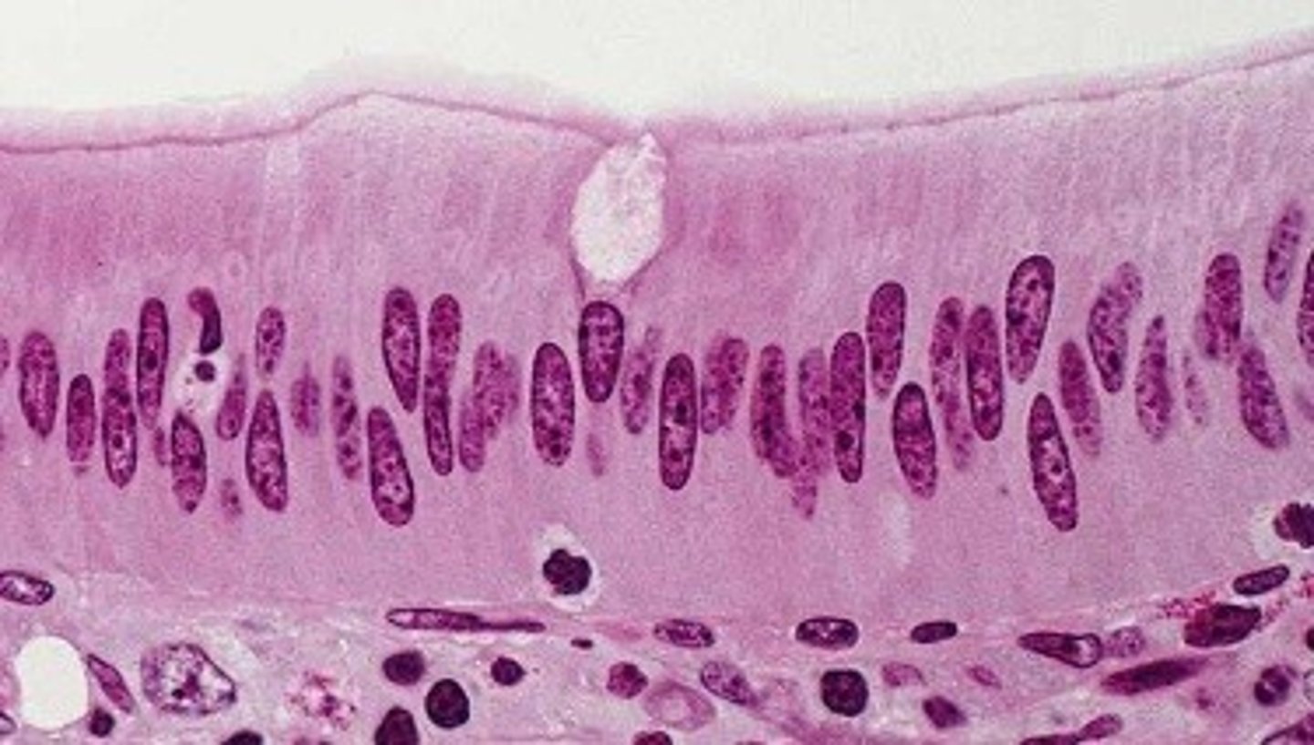 <p>Structure: One layer of "column-shaped" cells, basement membrane</p><p>Function: Absorption, secretion of mucus, enzymes and other substances</p><p>Location: Nonciliated type lines most of the digestive tract, gallbladder</p>