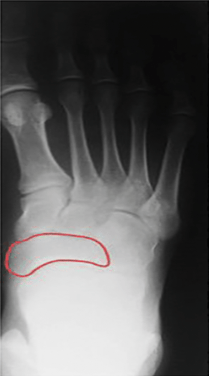 <p>What structure is highlighted?</p>