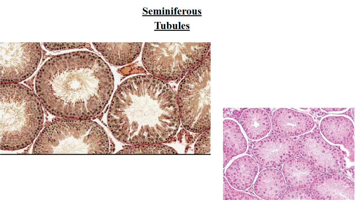 <p>seminiferous tubules</p>