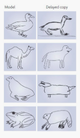 Semantic Dementia: Impaired Drawing