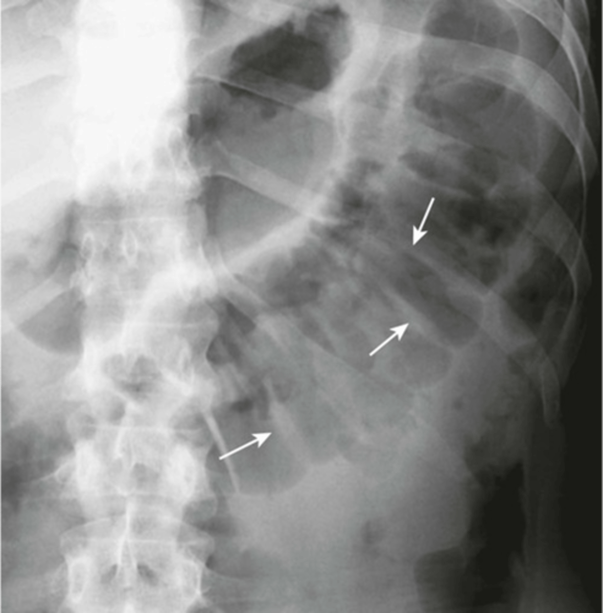 knowt flashcard image