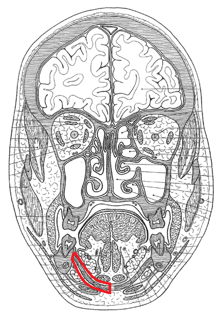 term image