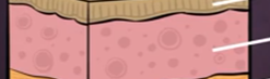 <p>Dermis-</p>