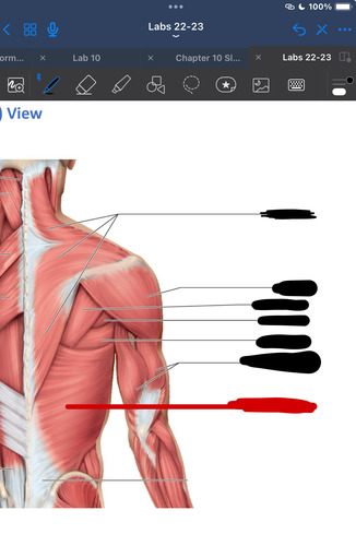 <p>What muscle is this?</p>