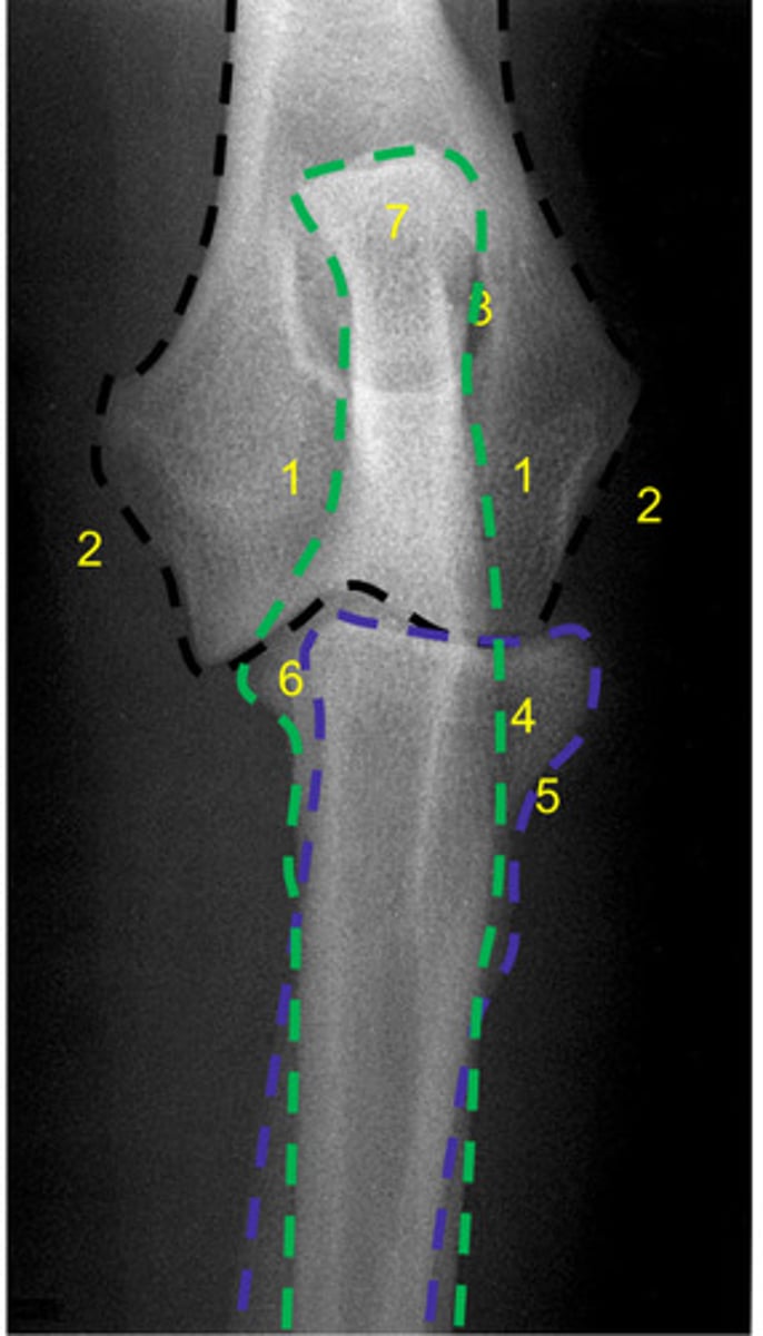 <p>What is number 4?</p>