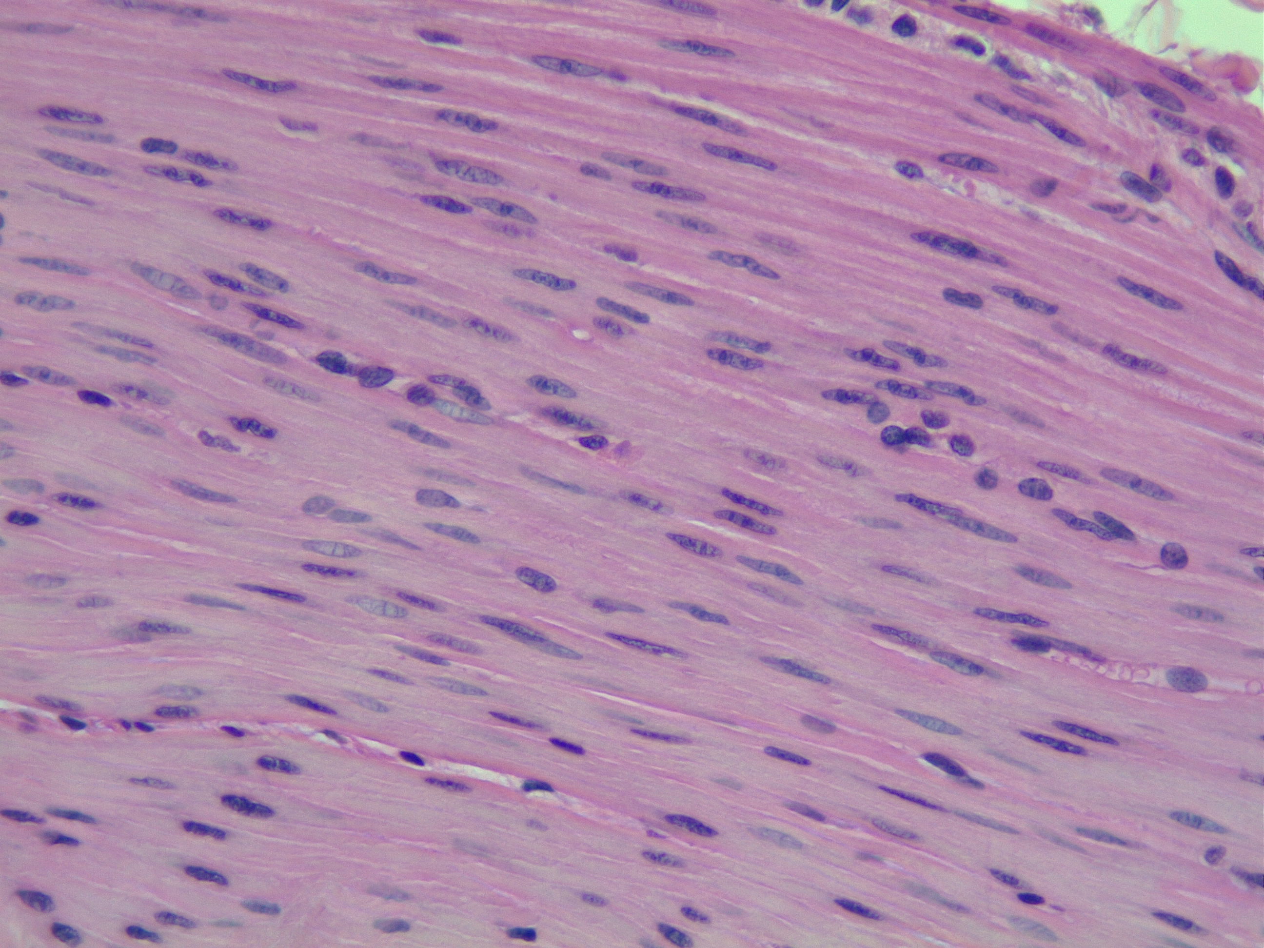 <p>Smooth musclen contains</p>