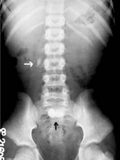 <p>XRAY optimized to assess the urogenital system ± GI system</p><p><em>Abdominal Radiograph</em></p>