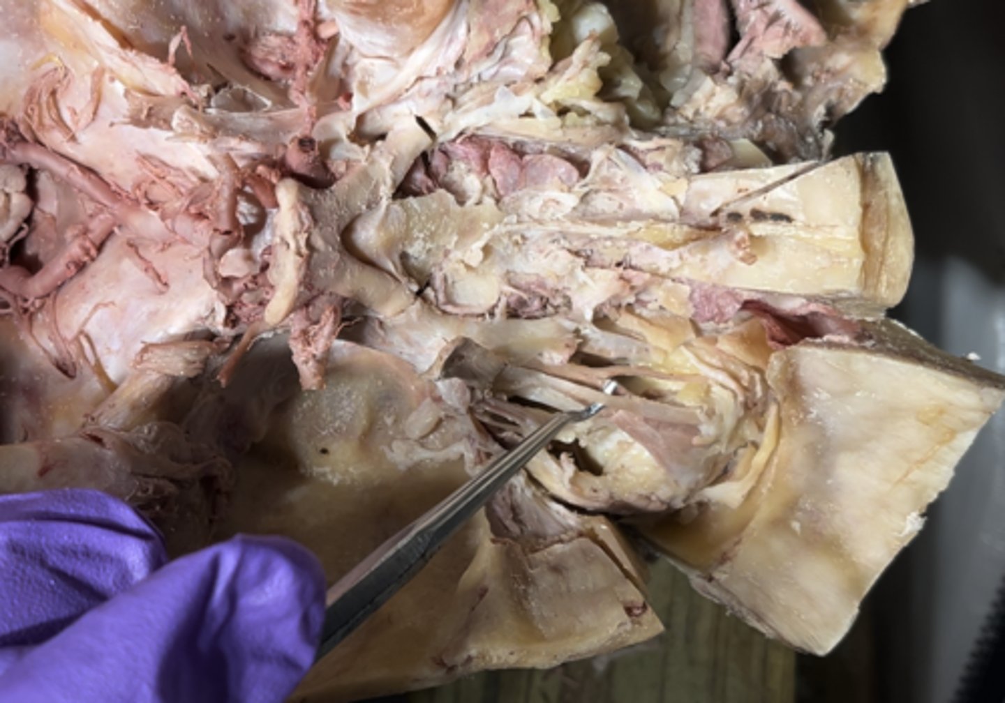 <p>The nerve running in the same "plane" as the levator palpebrae superioris muscle is the</p>