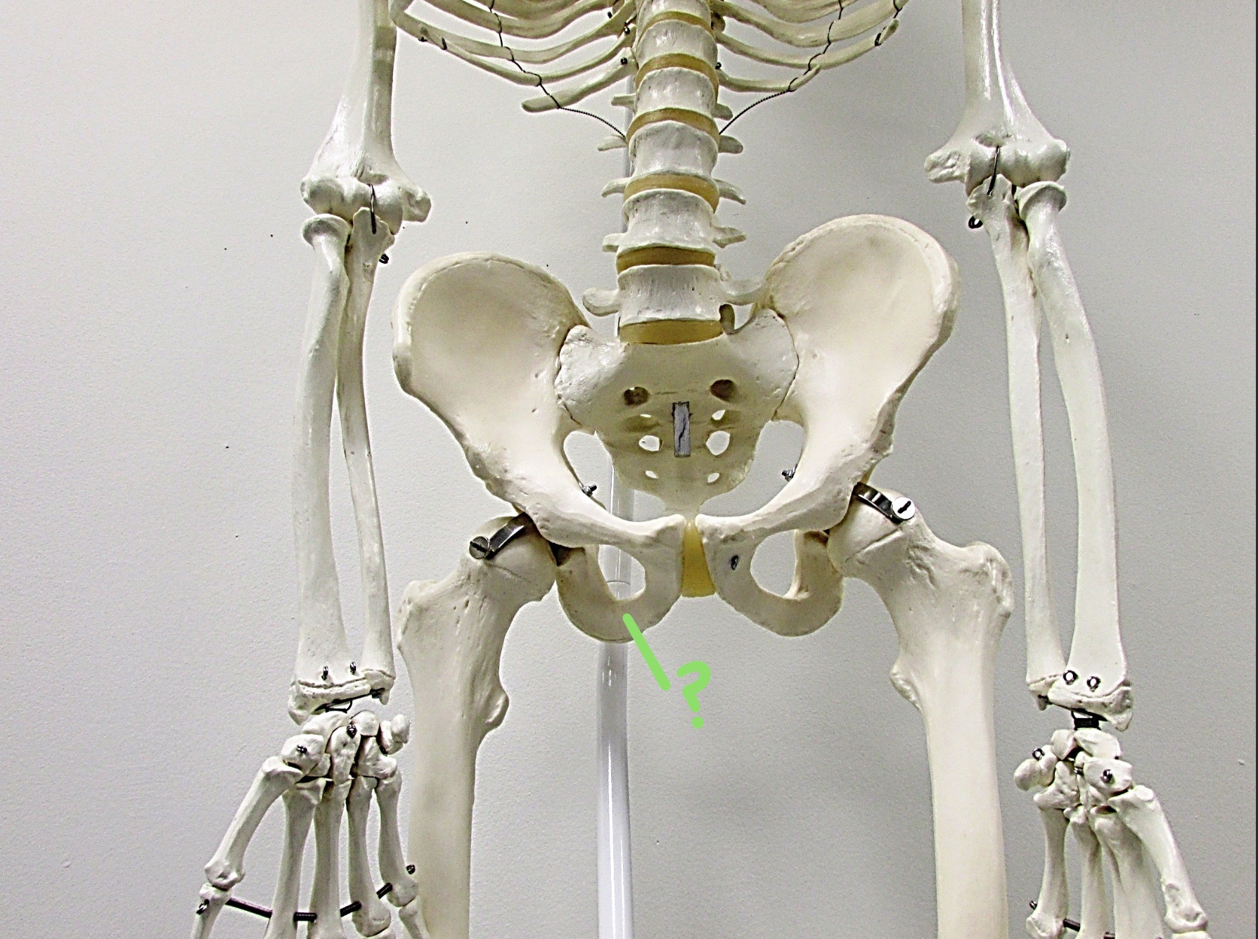 <p>Determine the part of the Coxa/Sacrum highlighted</p>