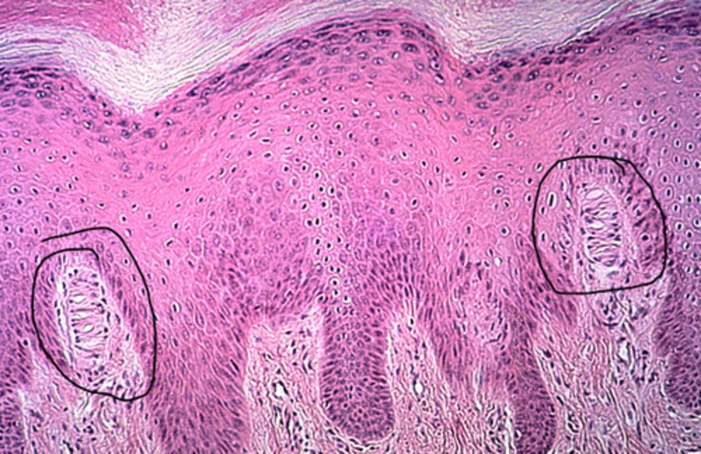 <p>DEFINITION</p><p>a sensory nerve ending that is sensitive to mechanical stimuli (light touch); found in the dermis in various parts of the body</p>