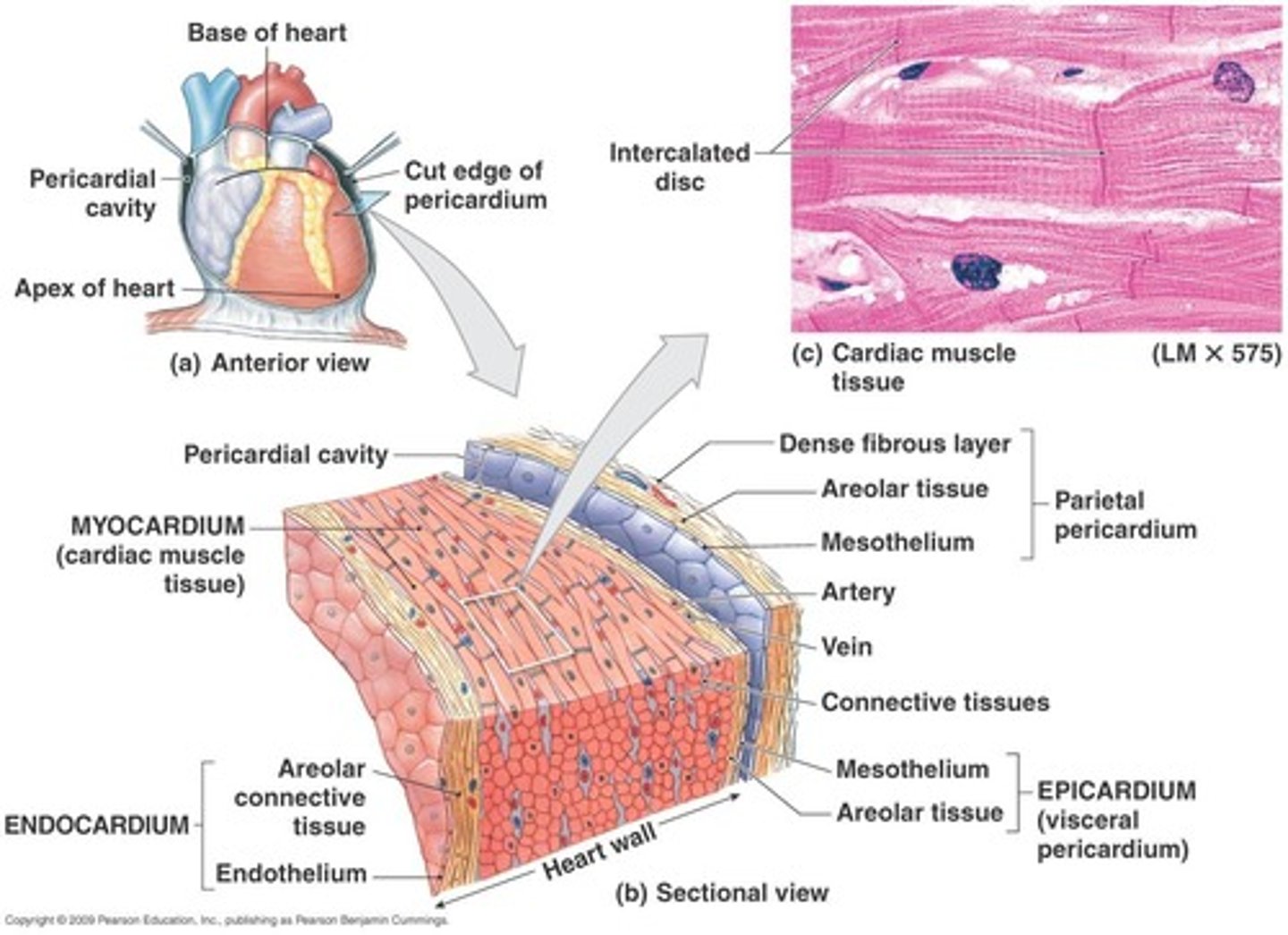 <p>Visceral pericardium (epicardium) and parietal pericardium.</p>
