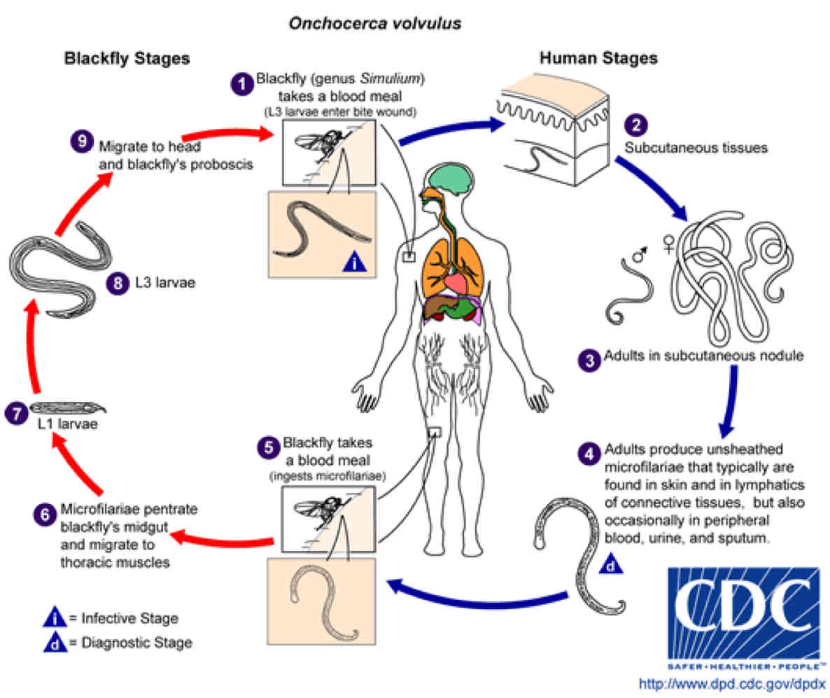 <p>1) Infected blackfly transfer infective Filarial larvae onto skin</p><p>2) Larvae enter bite wound (<strong>SQ nodules</strong>)</p><p>3) Larvae become adults </p><p>4) Adult female worms release microfilariae in skin &amp; lymph</p><p>5) Blackfly ingests worm </p>