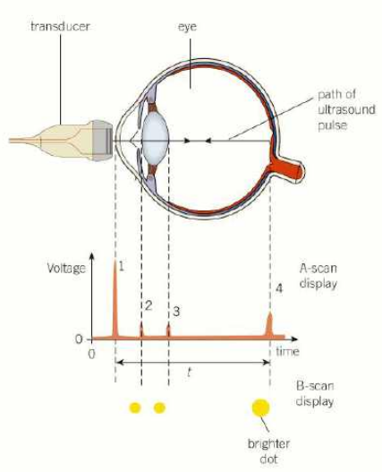 <ul><li><p>a stands for amplitude apparently</p></li><li><p>transducer records along a straight line through the patient</p></li><li><p>can be used to determine the thickness of bone or the distance between two tissues like lens and retina</p></li><li><p>when ultrasound pulse sent into patient, it is partly reflected and partly transmitted at boundary</p></li><li><p>reflected pulse has less energy and is detected at transducer</p></li><li><p>oscilloscope displays pulses as voltage against time</p></li><li><p>distance can be calculated by multiplying time difference between initial pulse by speed of ultrasound (and dividing by 2 probably)</p></li></ul><p></p>