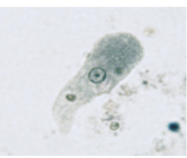 <p>Identify the entamoeba. Is parasitic and causes amoebic dysentery</p>
