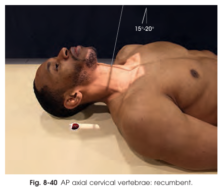 <p>Why should the chin be extended so the occlusal plane is perpendicular to the tabletop in the AP axial cervical projection?</p>