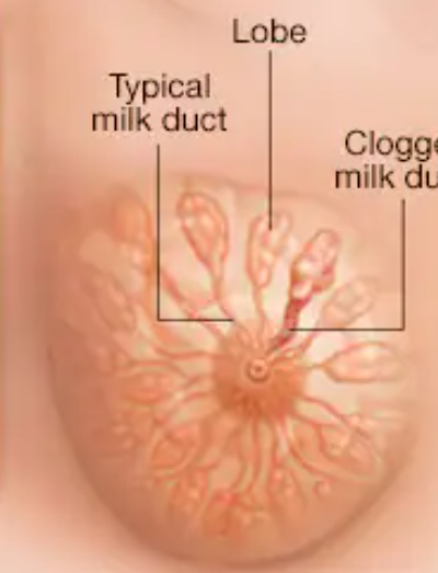<p>(Female Reprod Structures) What is this within the Breasts</p>