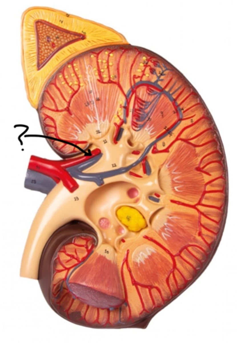 <p>Name this vessel.</p>