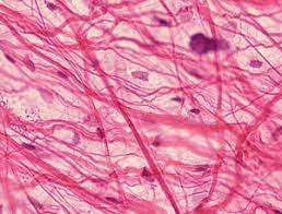 <p>Losses irregular arrangement of fibers and cells ( collagen, elastic, reticular, and fibroblasts fibers)</p>