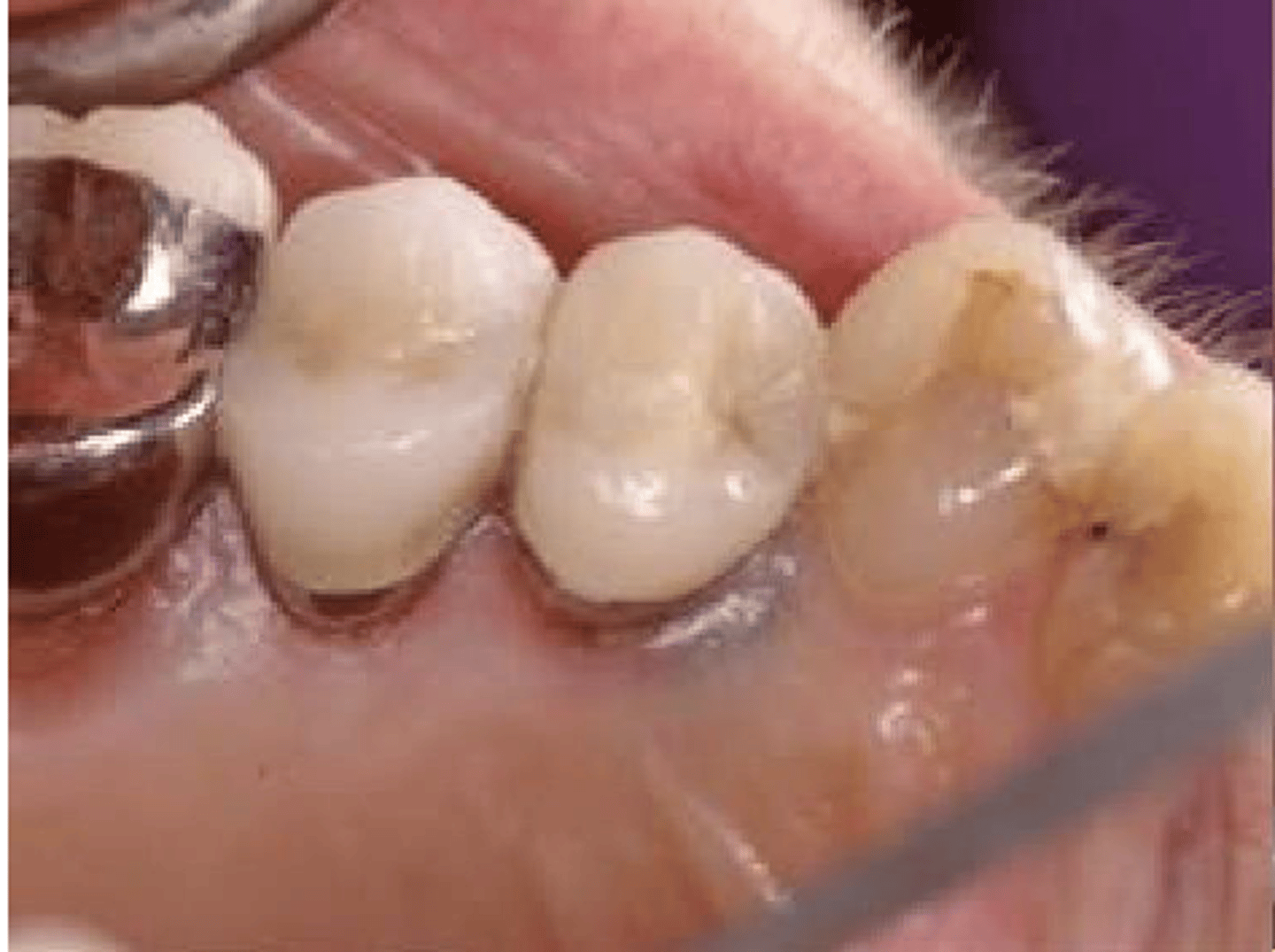 <p>What type of pigmented lesion?</p>