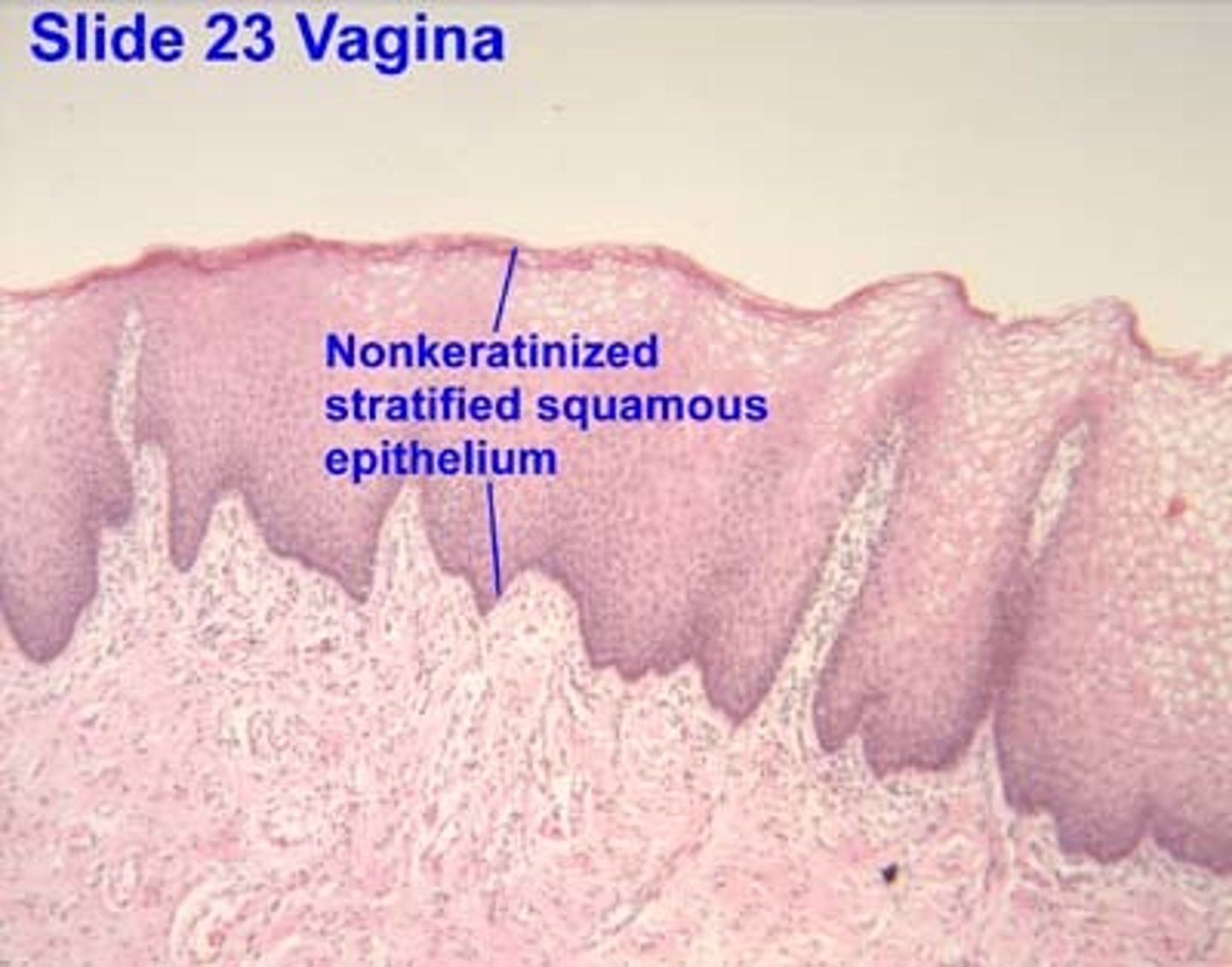 <p>Function: Protection of underlying tissue. </p><p>Location: Lining of the oral cavity</p><p>structure: multiple layers of flattened, squamous cells that do not produce keratin</p>