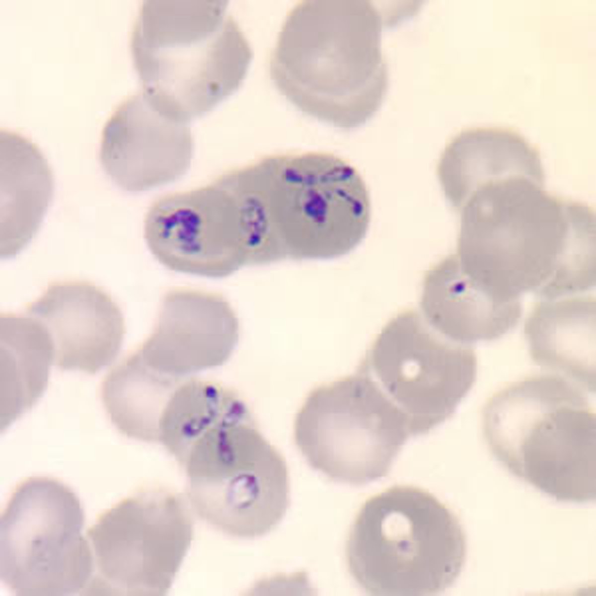 <p>form of Babesia spp. resembling 4 TROPHOZOITES attached by respective CHROMATIN DOTS inshape of MALTESE CROSS</p>